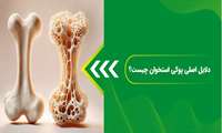 بخوانید | پوکی استخوان در یک نگاه